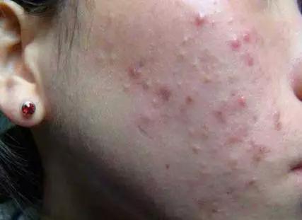 112f1ce9cc224bb7b67feb641507c0a5.jpg